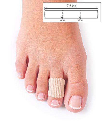 Отрезная защитная трубочка Todes ORTMANN для проблемных пальцев ног купить в OrtoMir24